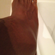 Image for article titled This Is What Serena Williams's Ankle Looks Like